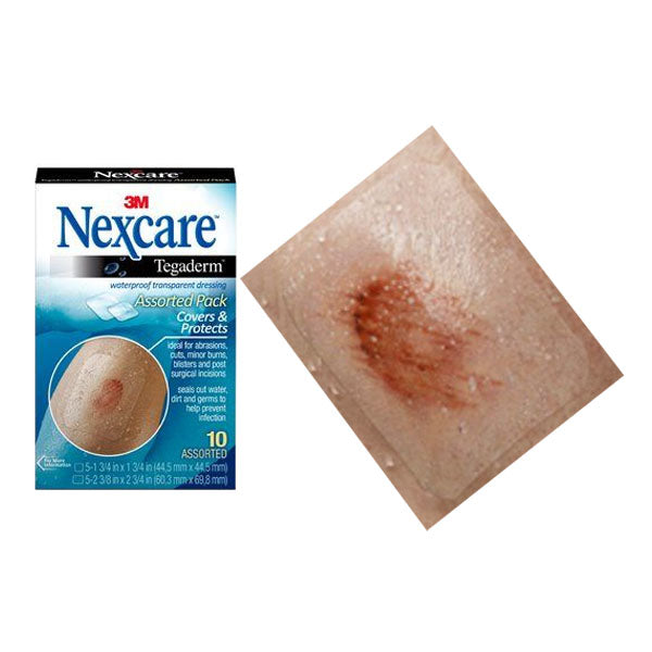 Nexcare Tegaderm Waterproof Transparent Dressing, 10 Count, Assorted Sizes Nexcare Tegaderm Waterproof Transparent Dressing, 10 Count, Assorted Sizes